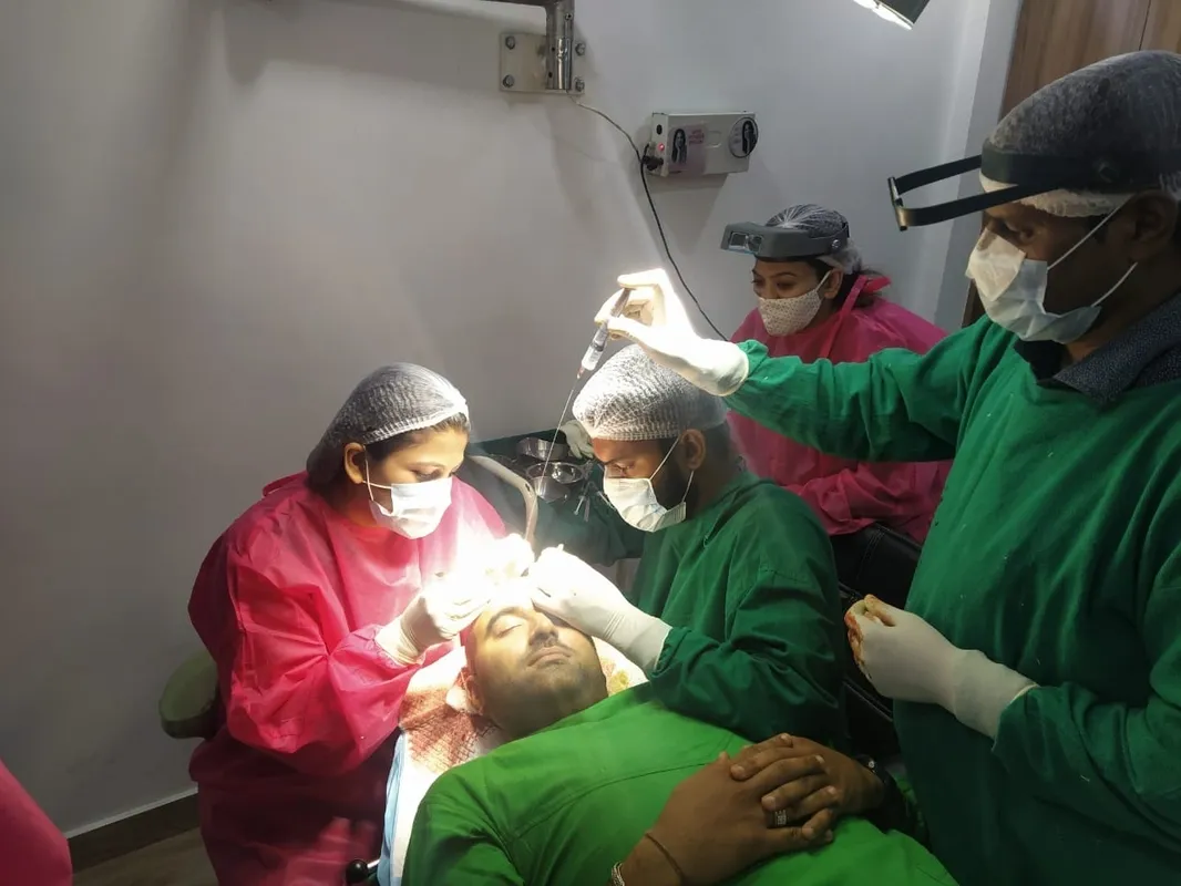 HAIR TRANSPLANT Treatment